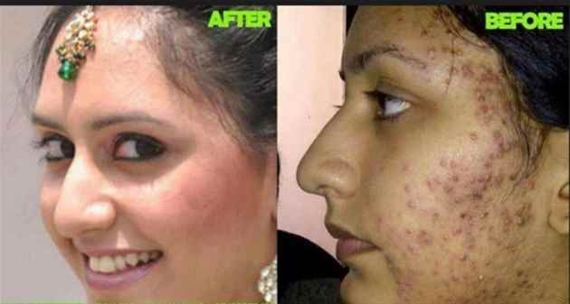 Skin whitening and lightening products 27739970300 answarsadat in uk,america,usa,itay,germany,canada
